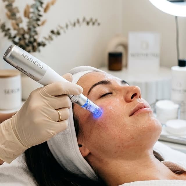 Microneedling x 3 Hair Growth at E&E Esthetics in Fort Lupton, CO