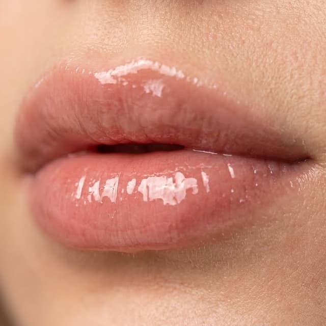 Hydralips at E&E Esthetics in Fort Lupton, CO